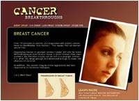 Cancer Breakthroughs: Finding Answers